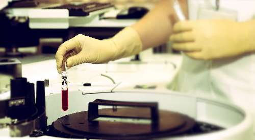 Ein Reagenzglas mit Blut
